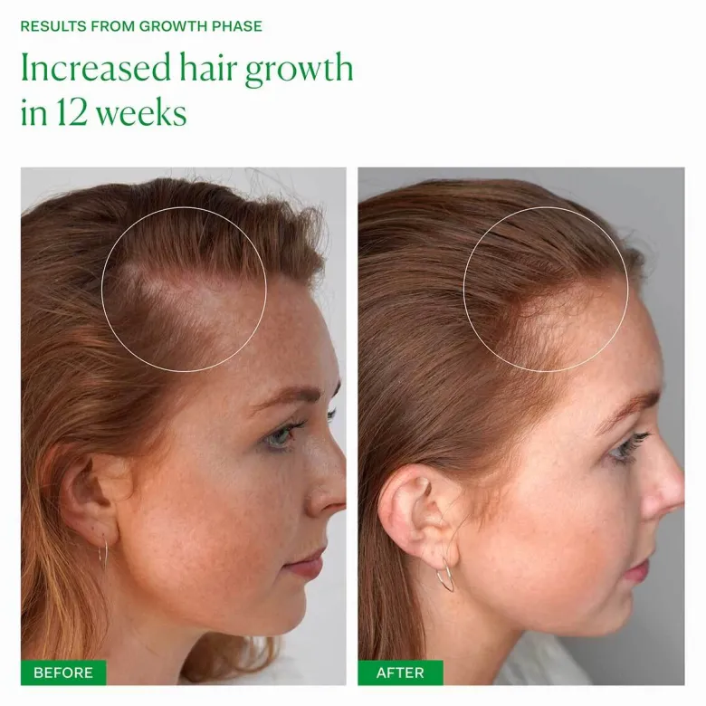 Growth Phase
