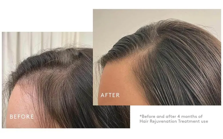 Hair Rejuvenation Treatment Set