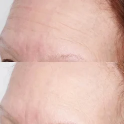High Potency Hyaluronic Intensive Hydrating Mask