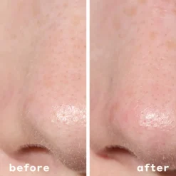 2-In-1 Deep Cleansing Pore Strip