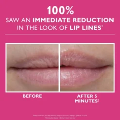 Instant FirmX Lip Filler