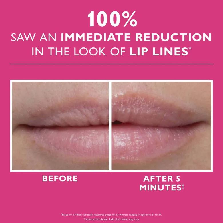 Instant FirmX Lip Filler