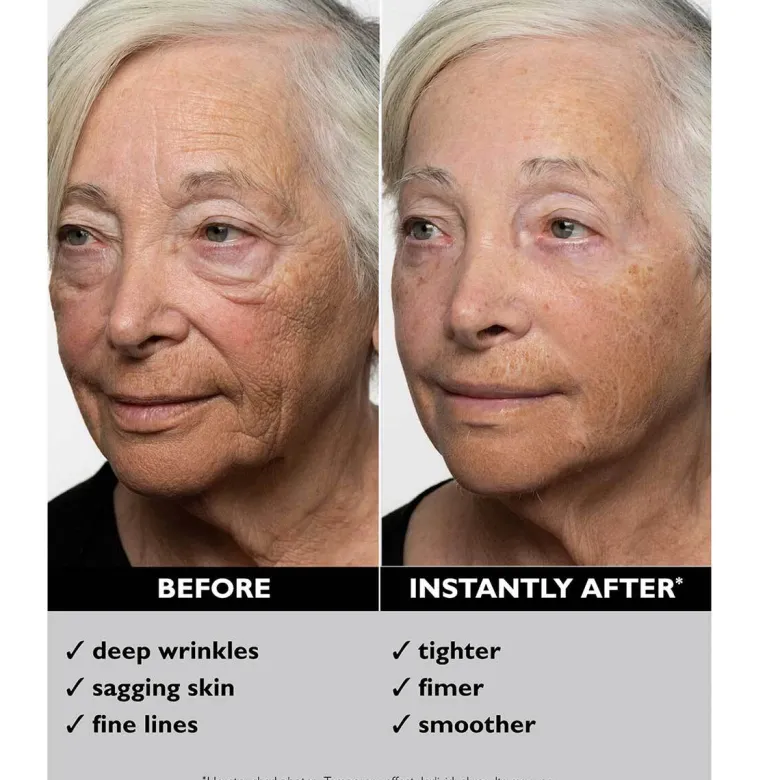 Instant FIRMx® Temporary Face Tightener