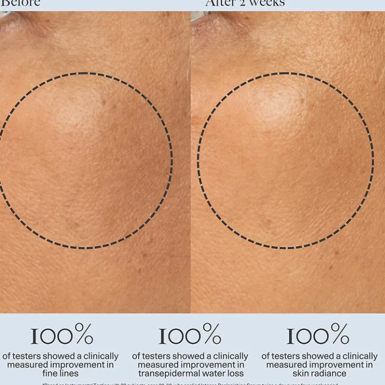 Intense Replenishing Serum
