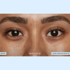 IONPLEX® HYDRA-GEL POWER PATCHES