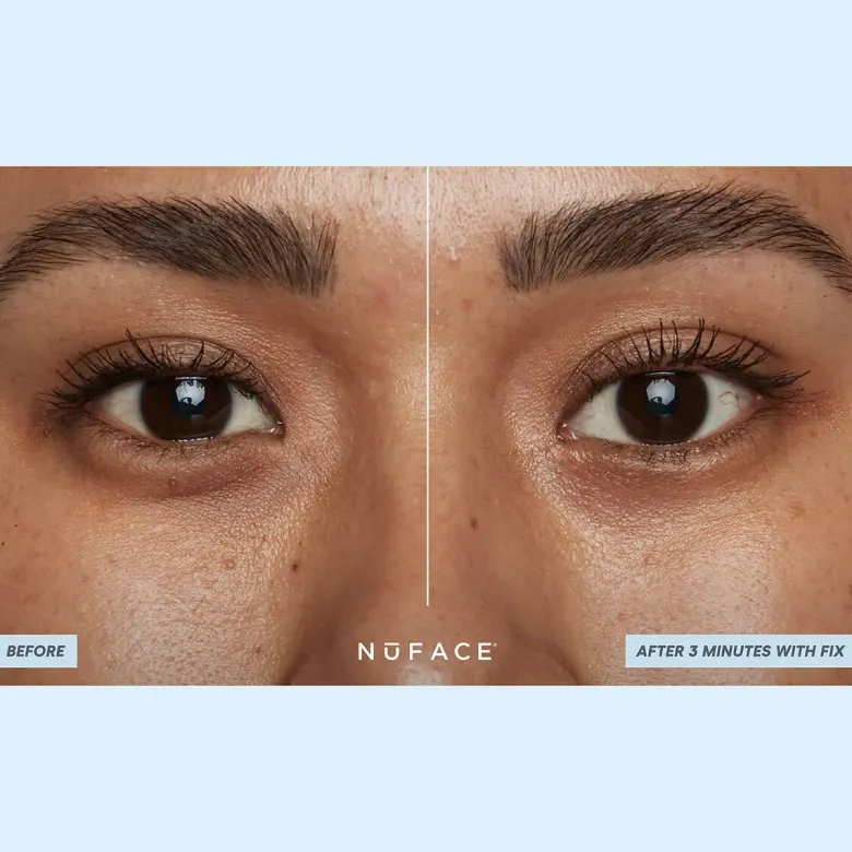 IONPLEX® HYDRA-GEL POWER PATCHES
