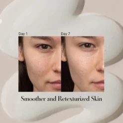Lactic Acid Serum