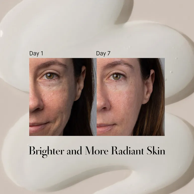 Lactic Acid Serum