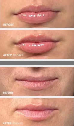 Lip Oasis Glossy Treatment
