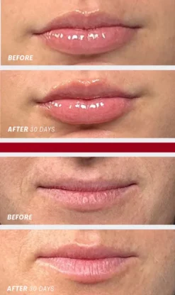 Lip Oasis Glossy Treatment