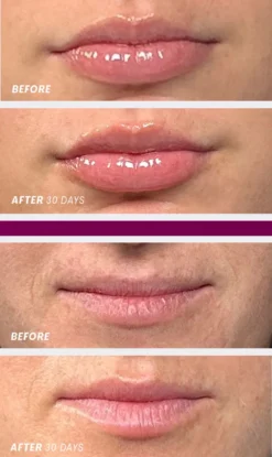Lip Oasis Glossy Treatment