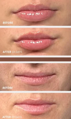 Lip Oasis Glossy Treatment