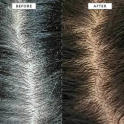 MegaStrength + Dandruff Control Shampoo Charcoal + AHA/BHA