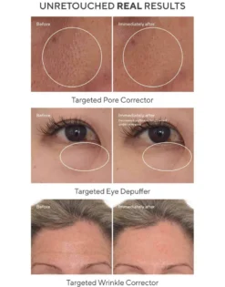 5-Minute Fix: Targeted Correctors