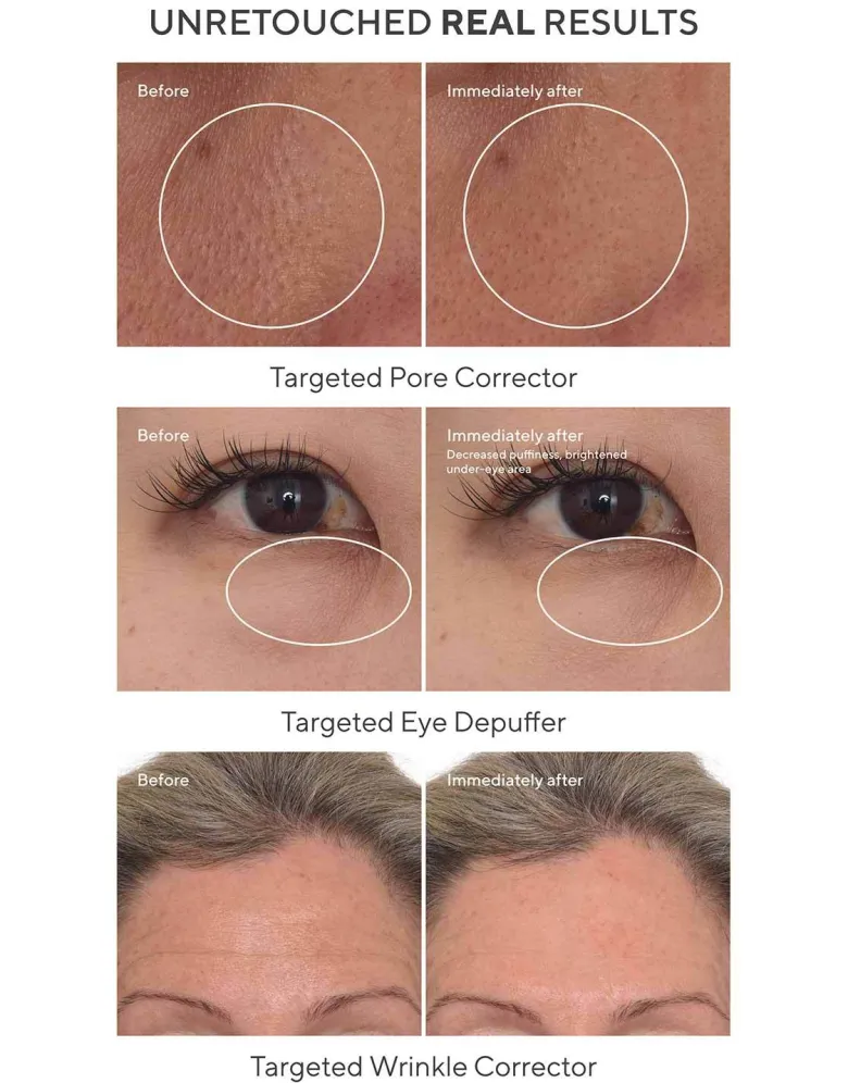 5-Minute Fix: Targeted Correctors