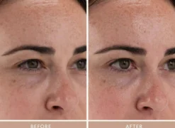 Moisture Boost Plumping Serum