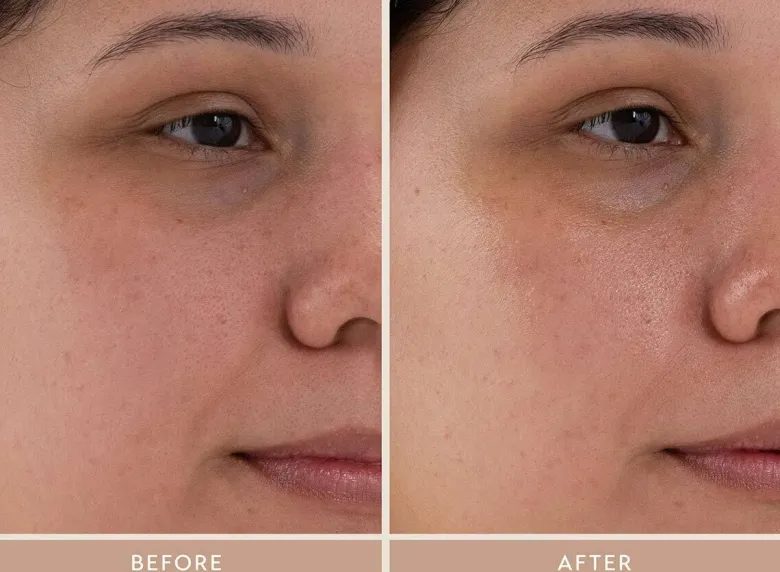 Moisture Boost Plumping Serum