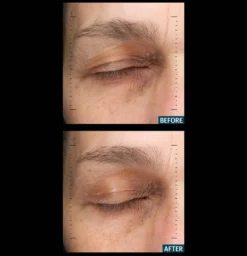 Multi Peptides & GF Advanced Lifting Serum