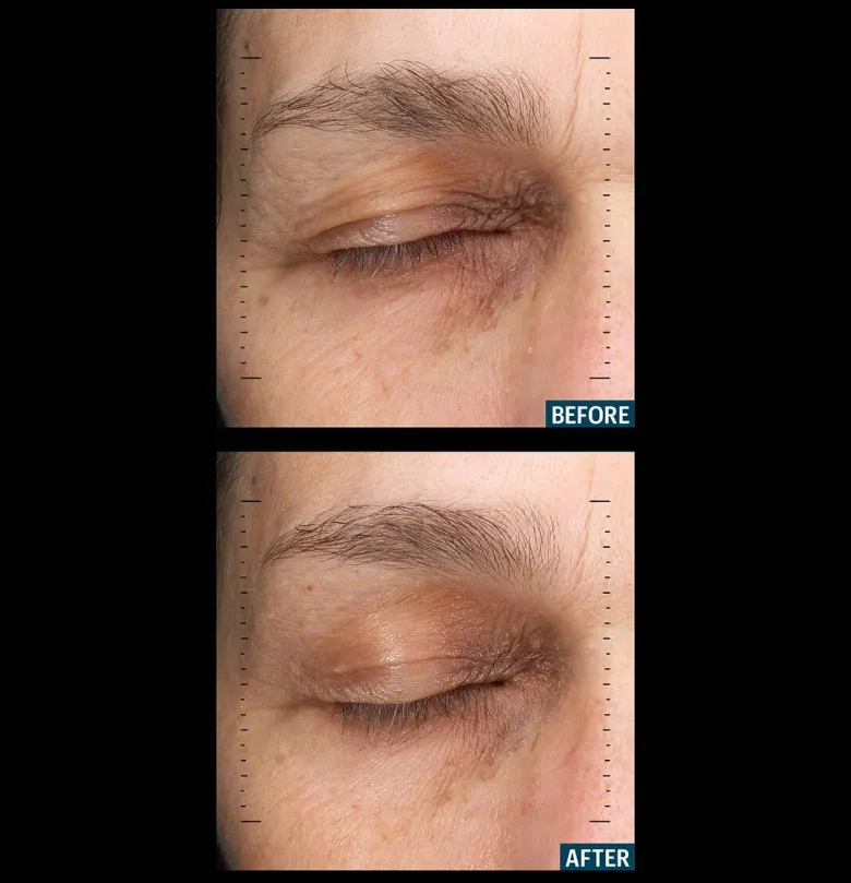 Multi Peptides & GF Advanced Lifting Serum