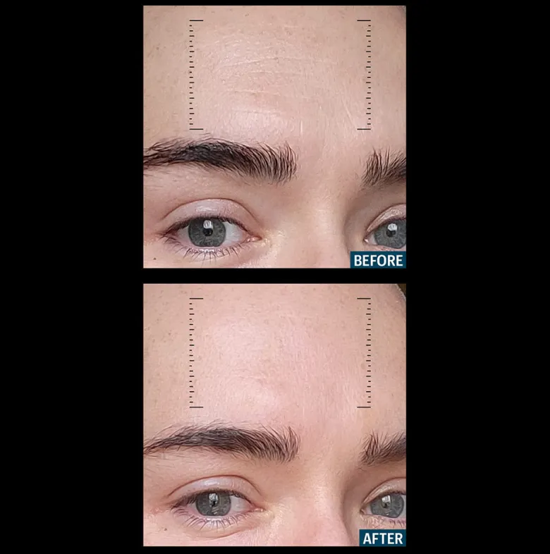 Multi Peptides & GF Advanced Lifting Serum