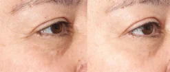 Neuropeptide Corrective Brightening Under-Eye Cream