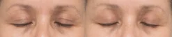 Neuropeptide Eyelid lift Serum