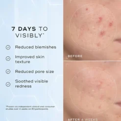 Niacinamide Peptides