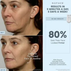 NuFACE TRINITY® ELE Effective Lip & Eye Attachment