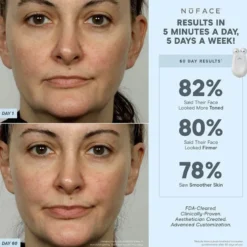 NuFACE TRINITY® ELE Effective Lip & Eye Attachment