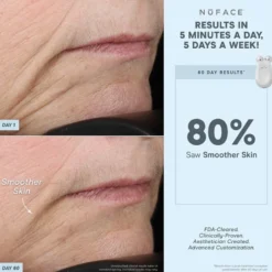 NuFACE TRINITY® ELE Effective Lip & Eye Attachment