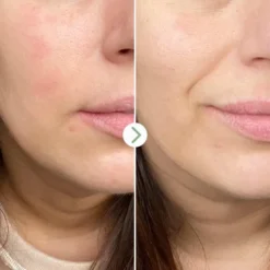 Partners in Calm Cleanser & Moisturizer Set