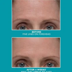 Peptide Skinjection™ Amplified Wrinkle-Fix Serum