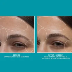 Peptide Skinjection™ Moisture Infusion Cream