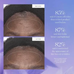 Plant Stem Cell Retinol Alternative Moisturizer