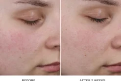 Pore Refining Complex
