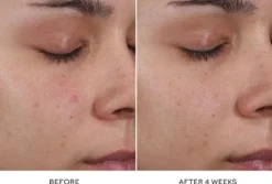 Pore Refining Complex