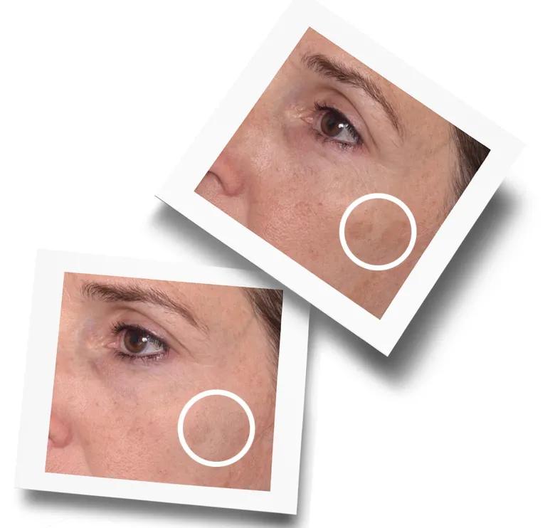 Rapid Dark Spot Correcting Serum