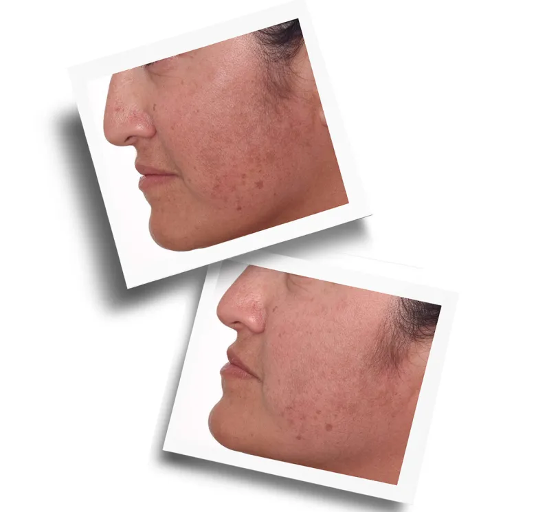Rapid Dark Spot Correcting Serum