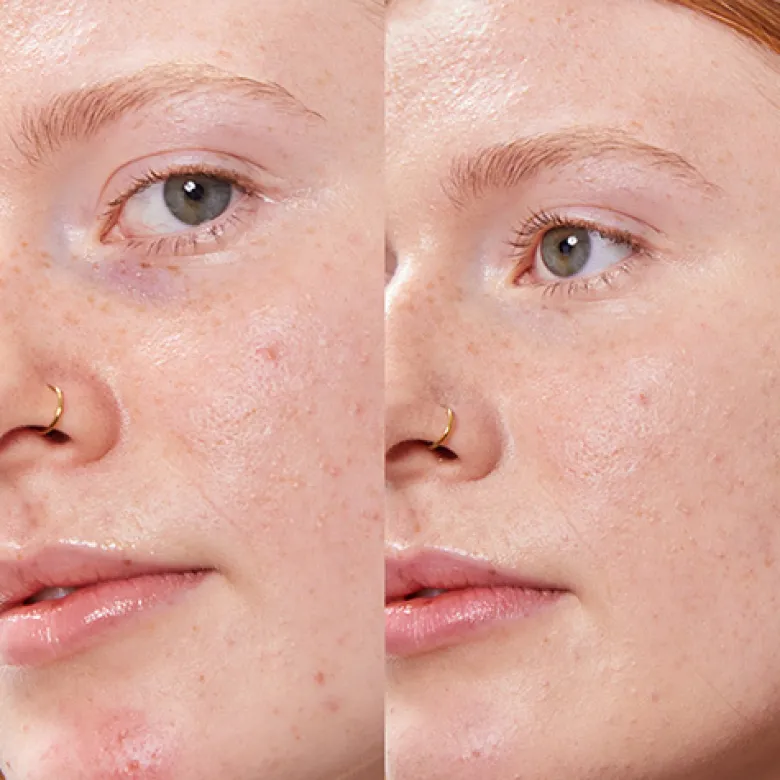 Refill Concealer Balm