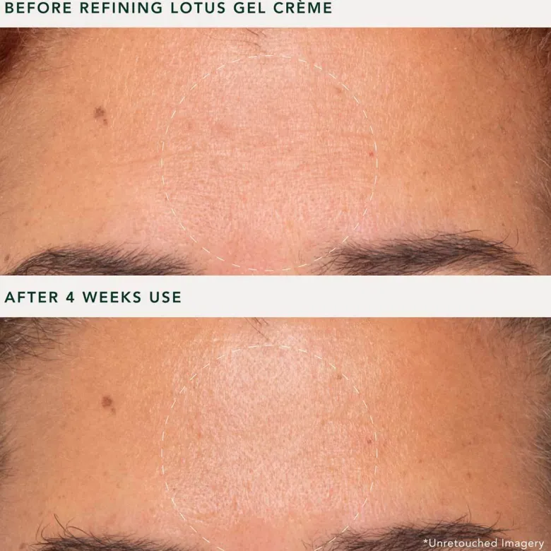 Refining Lotus Gel Crème