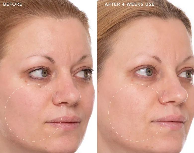 Refining Lotus Gel Crème