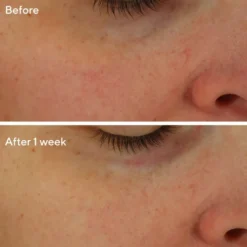 Restorative Hydro-Hyaluronic Cream