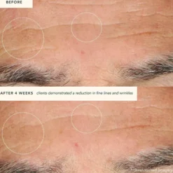 Restoring Moonseed Treatment