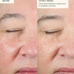 Restoring Moonseed Treatment