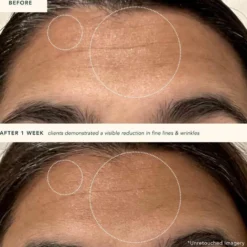 Restoring Moonseed Treatment