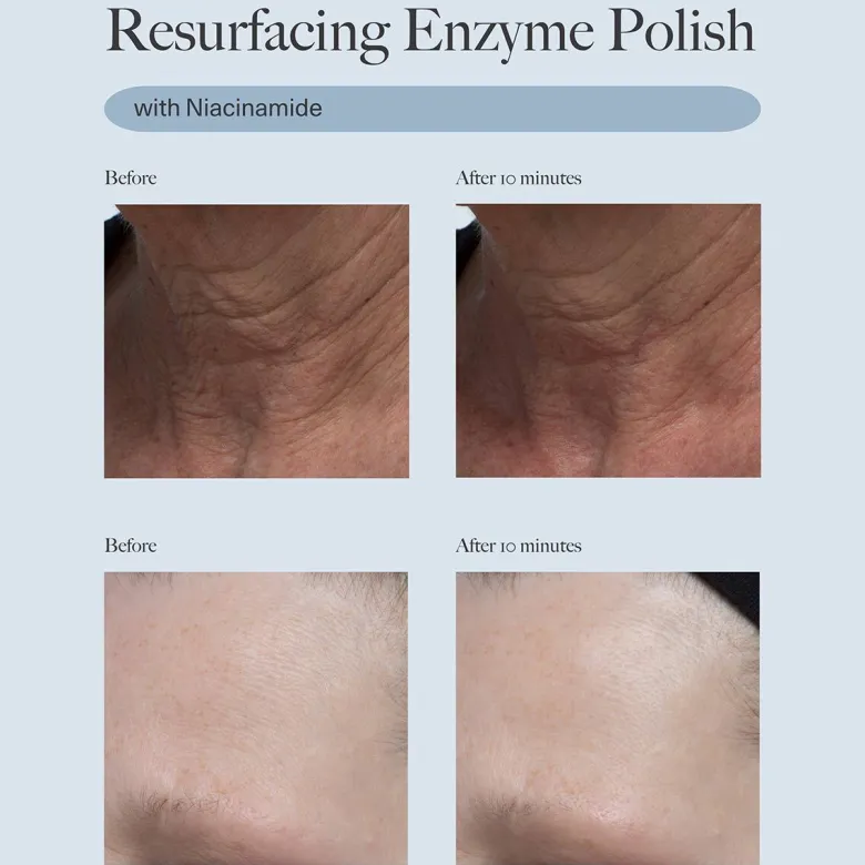 Resurfacing Enzyme Polish