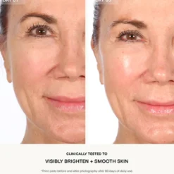 Resurfacing Flash Peel