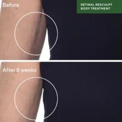 Retinal Resculpt Body Treatment
