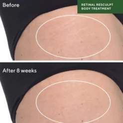Retinal Resculpt Body Treatment