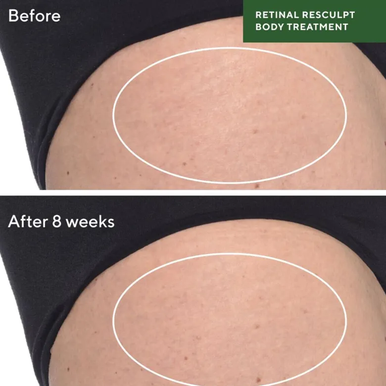 Retinal Resculpt Body Treatment